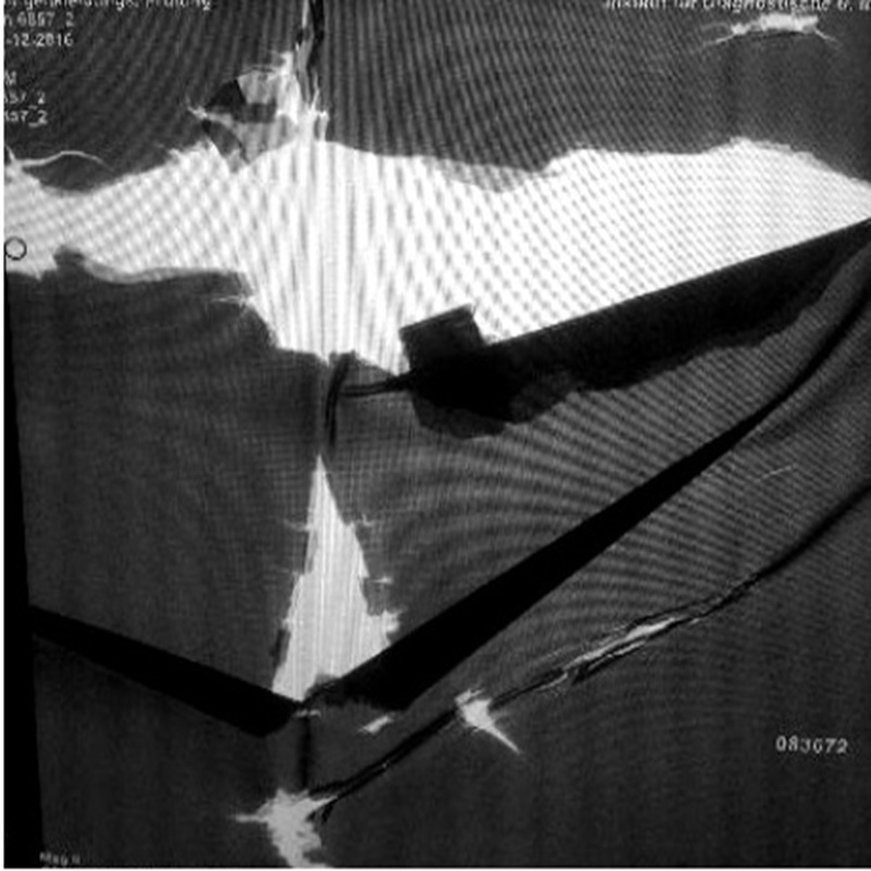 Durchleuchtungsaufnahme einer Röntgenschürze mit Delamination der Schutzschicht